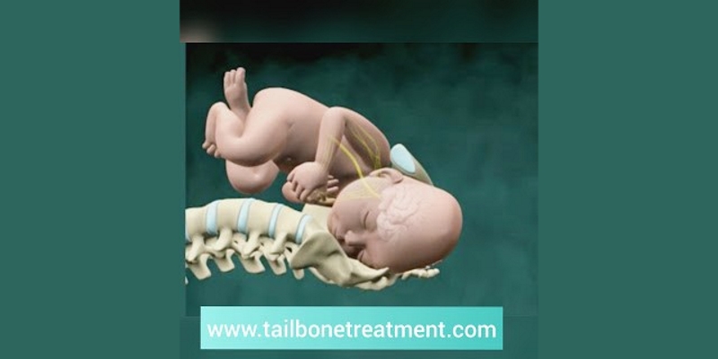 What to do when pregnancy becomes a pain in the tailbone, Your Pregnancy  Matters